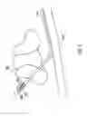 Fig. 06 - Methods of shielding implantable medical leads and implantable medical lead extensions