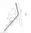Fig. 09 - Methods of shielding implantable medical leads and implantable medical lead extensions