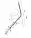 Fig. 11 - Methods of shielding implantable medical leads and implantable medical lead extensions
