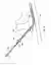 Fig. 17 - Methods of shielding implantable medical leads and implantable medical lead extensions