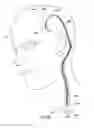 Fig. 19 - Methods of shielding implantable medical leads and implantable medical lead extensions