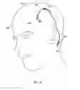 Fig. 20 - Methods of shielding implantable medical leads and implantable medical lead extensions