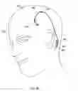 Fig. 21 - Methods of shielding implantable medical leads and implantable medical lead extensions