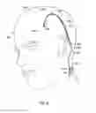 Fig. 22 - Methods of shielding implantable medical leads and implantable medical lead extensions