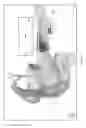 Fig. 03 - Interventional drug delivery system and associated methods