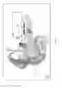 Fig. 08 - Interventional drug delivery system and associated methods