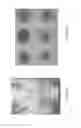 Fig. 23 - Interventional drug delivery system and associated methods