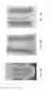 Fig. 25 - Interventional drug delivery system and associated methods