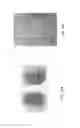 Fig. 29 - Interventional drug delivery system and associated methods
