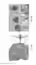 Fig. 34 - Interventional drug delivery system and associated methods