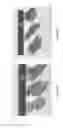 Fig. 37 - Interventional drug delivery system and associated methods