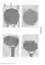 Fig. 40 - Interventional drug delivery system and associated methods