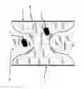 Fig. 08 - Apparatus and method for treating multiple tumors in patients with metastatic disease by electric fields