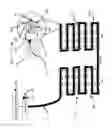 Fig. 11 - Apparatus and method for treating multiple tumors in patients with metastatic disease by electric fields