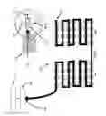 Fig. 16 - Apparatus and method for treating multiple tumors in patients with metastatic disease by electric fields