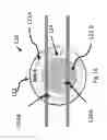 Fig. 17 - Apparatus and method for treating multiple tumors in patients with metastatic disease by electric fields