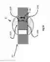 Fig. 26 - Apparatus and method for treating multiple tumors in patients with metastatic disease by electric fields