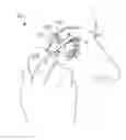 Fig. 01 - Stimulation patterns for treating dry eye