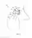 Fig. 04 - Stimulation patterns for treating dry eye