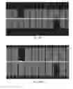 Fig. 15 - Stimulation patterns for treating dry eye