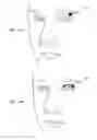 Fig. 17 - Stimulation patterns for treating dry eye