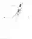 Fig. 09 - Miniature implantable device and methods
