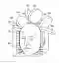 Fig. 01 - TRANSCRANIAL MAGNETIC STIMULATION FIELD SHAPING