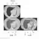 Fig. 04 - System and method for irradiation therapy using voxel based functional measurements of organs at risk