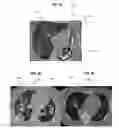 Fig. 05 - System and method for irradiation therapy using voxel based functional measurements of organs at risk