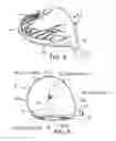 Fig. 03 - Golf club