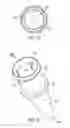 Fig. 03 - REAGENT WELL HAVING A CAPILLARY INSERT