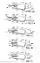 Fig. 06 - DEVICE AND METHOD FOR PRODUCING CLAMPS BENT FROM WIRE SECTIONS