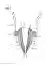 Fig. 03 - NOZZLE FOR LASER POWDER BUILD-UP WELDING