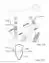 Fig. 11 - Blasting system and method of use