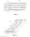 Fig. 04 - Fluid structure with compression molded fluid channel