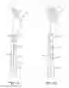 Fig. 03 - Overmolded cutlery articles
