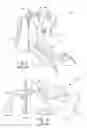 Fig. 02 - Variable ratio throttle pedal