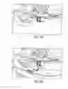 Fig. 03 - Hands free vehicle charging system