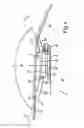 Fig. 04 - Arrangement having a trim component and a radar sensor, motor vehicle and method for manufacturing an arrangement