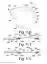 Fig. 25 - Beverage Can Closing Member