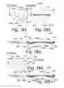 Fig. 49 - Beverage Can Closing Member