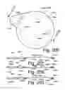 Fig. 56 - Beverage Can Closing Member
