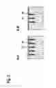 Fig. 04 - Microelectromechanical component and manufacturing method for microelectromechanical components