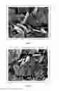 Fig. 03 - Process for producing fine, morphologically optimized particles using jet mill, jet mill for use in such a process and particles produced