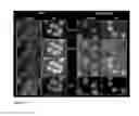 Fig. 20 - COMPOUNDS AND METHODS FOR TREATING CANCERS