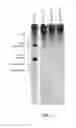 Fig. 02 - RNA purification methods