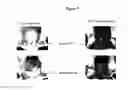 Fig. 08 - Promoting Apoptosis Of Differentiated Adipocytes And Increasing Endogenous Expression Of sFRP-5 Peptide By Adipocytes By Administration Of sFRP-5 Peptide