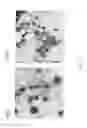 Fig. 10 - Methods and compositions based on diphtheria toxin-interleukin-3 conjugates