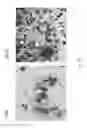 Fig. 12 - Methods and compositions based on diphtheria toxin-interleukin-3 conjugates