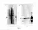 Fig. 15 - Non-hemolytic LLO fusion proteins and methods of utilizing same